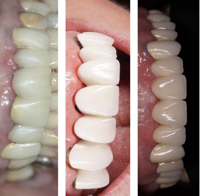 make natural looking teeth great again
