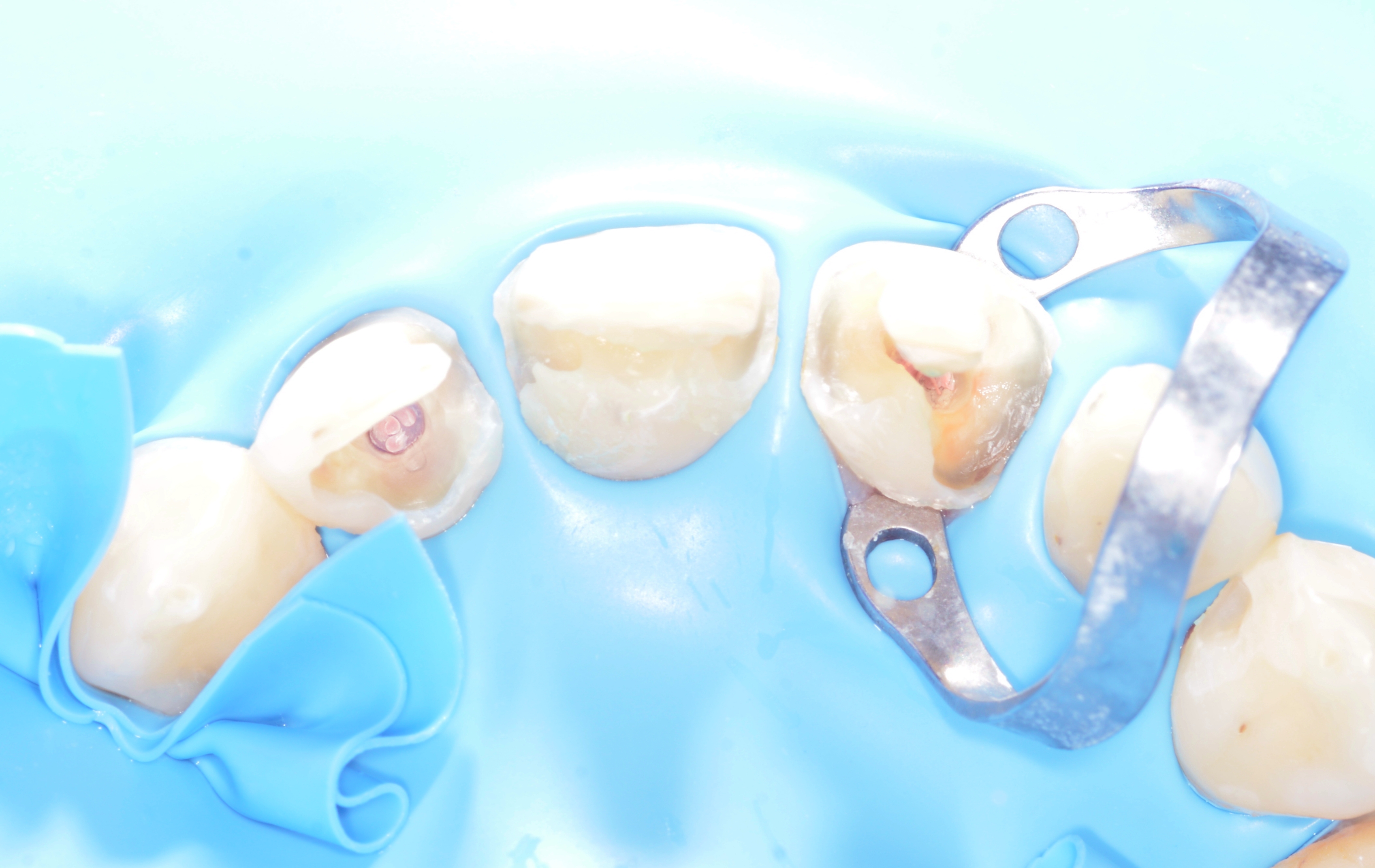 Endodontie