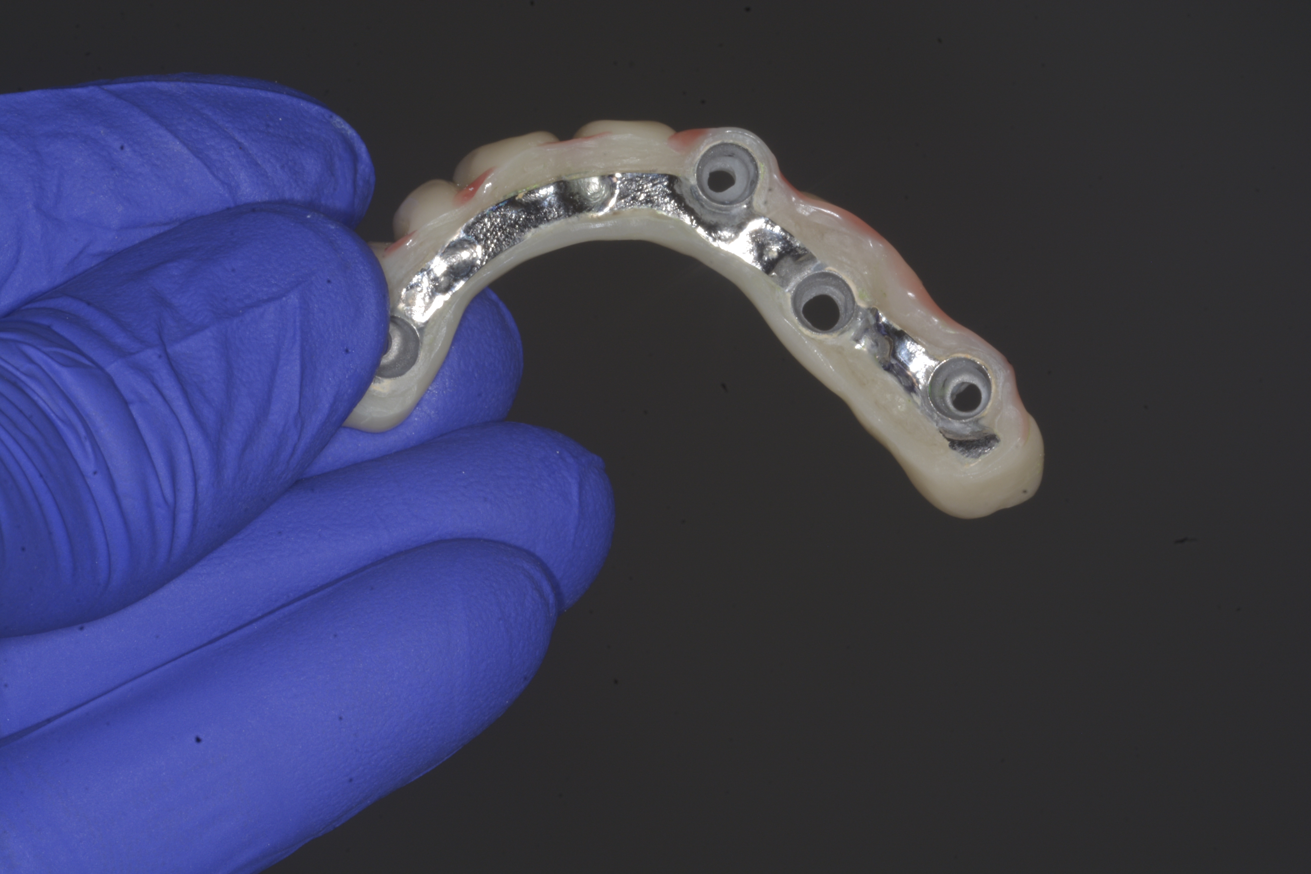 Implanturi dentare