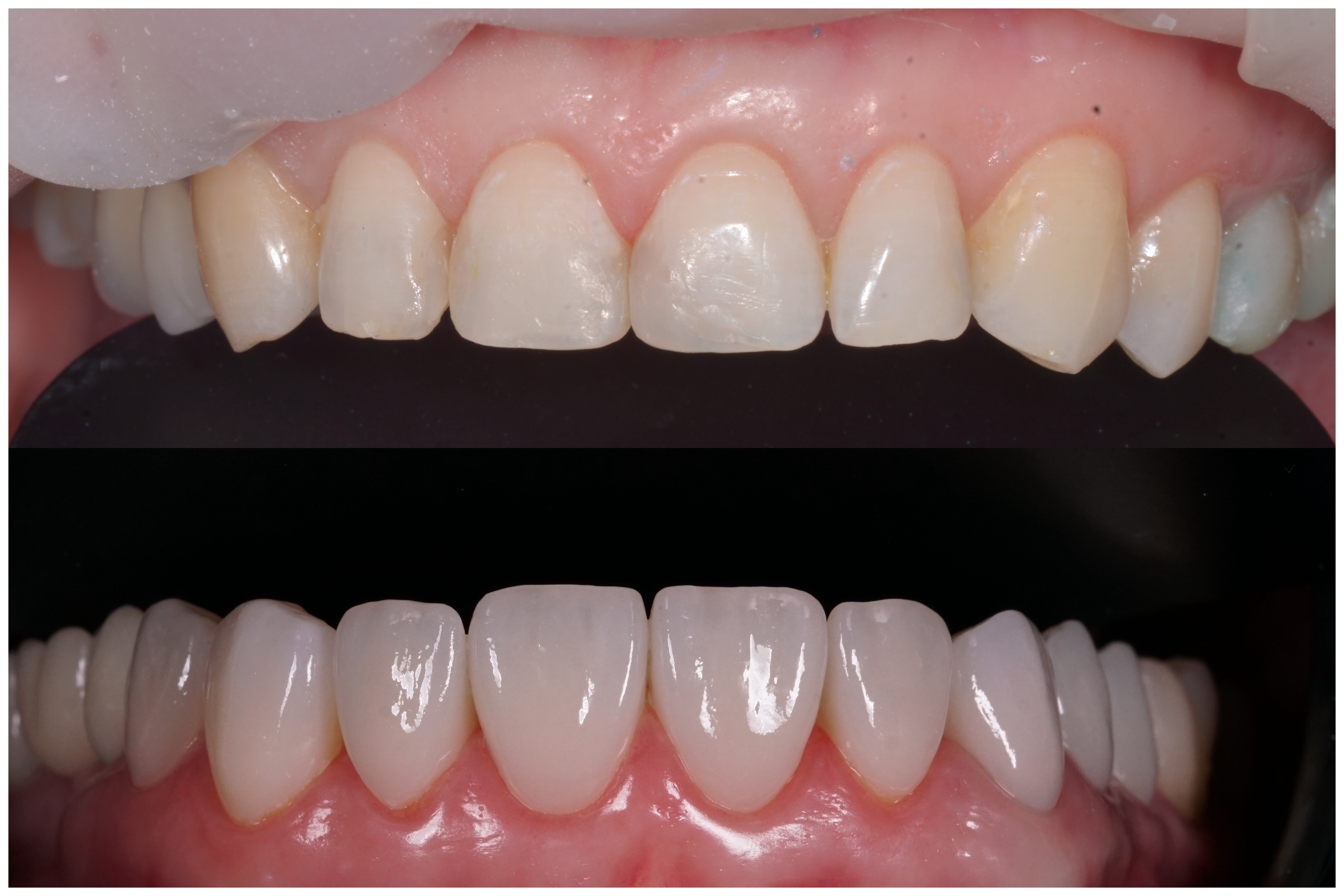 Estetică dentară