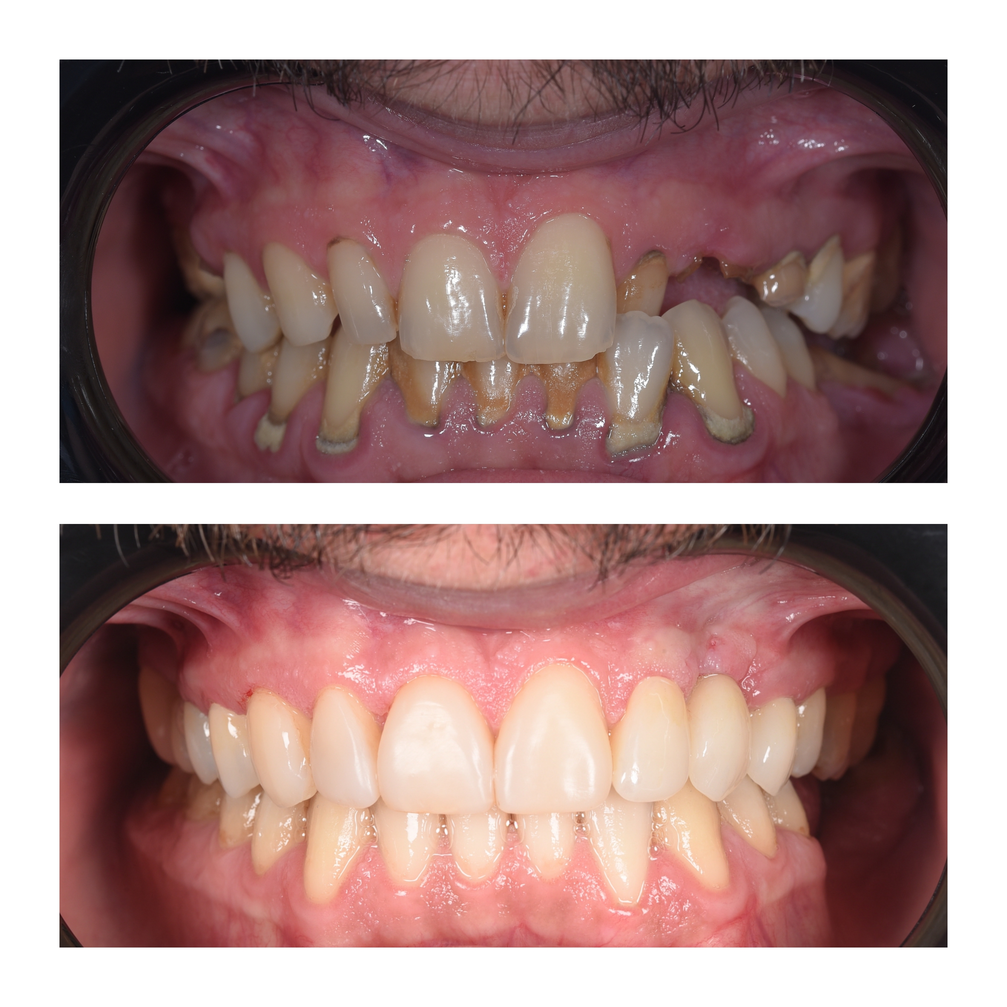 Protetică dentară