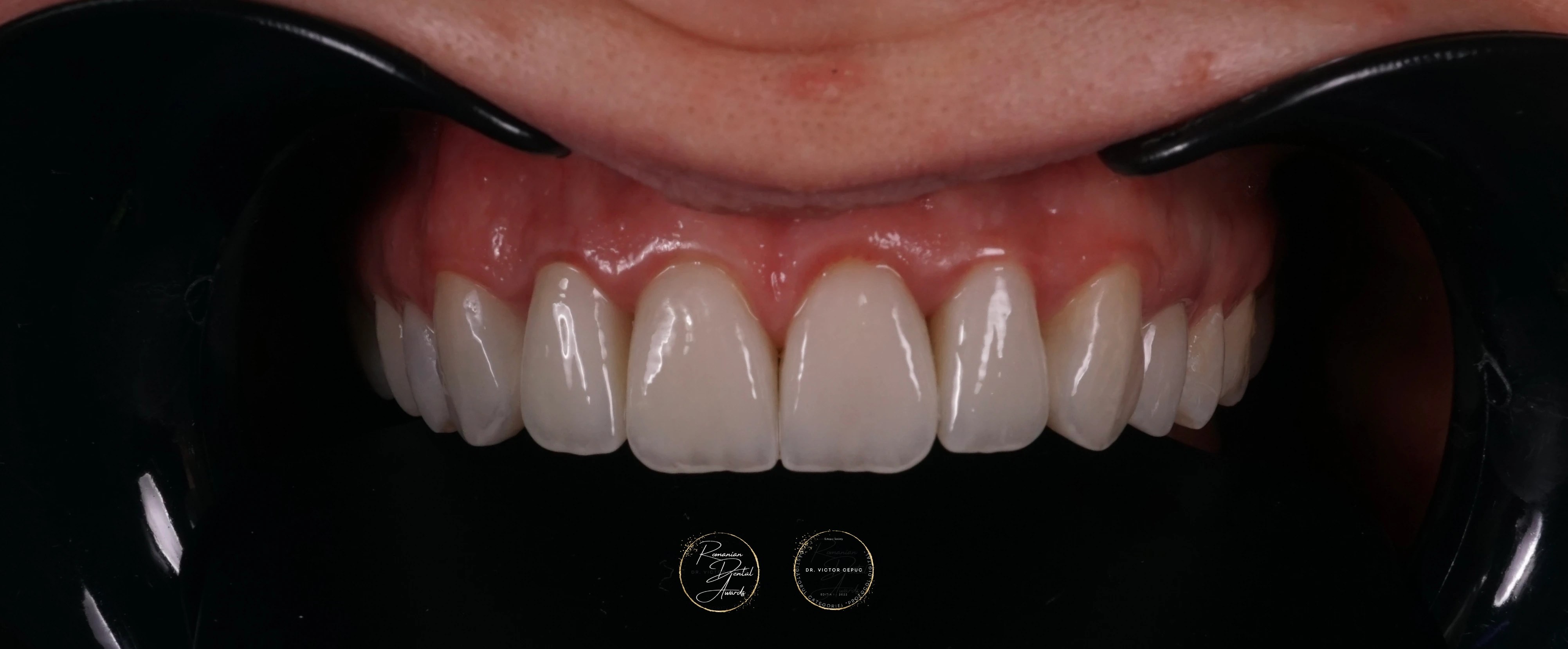 Dr. Victor Cepuc - Câștigător Romanian Dental Awards